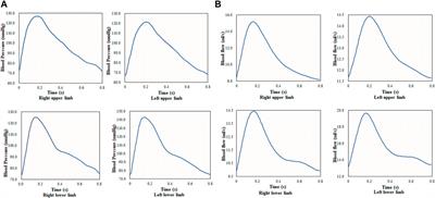 Non-invasive hemodynamic diagnosis based on non-linear pulse wave theory applied to four limbs